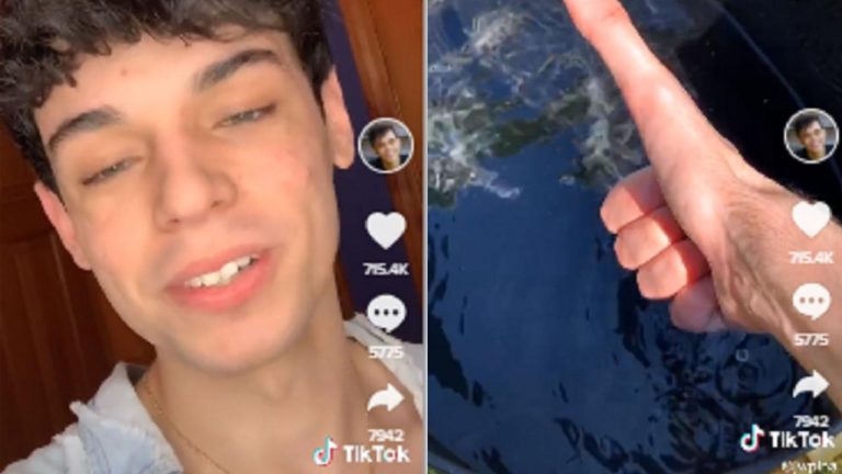 Miliki Jempol Super Panjang Pria Ini Viral di TikTok